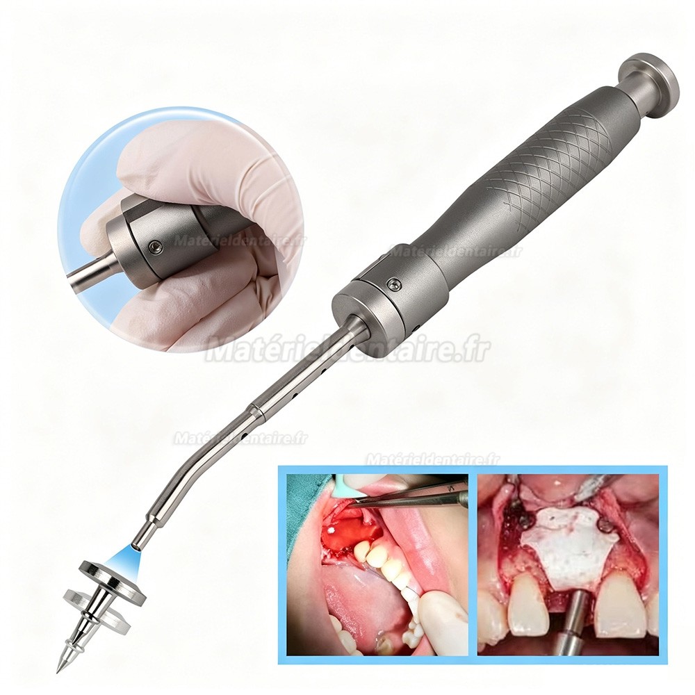 SEGMA Kit de mini-fixation automatiques des membranes avec 30 fixations de 3 mm/4 mm pour FGG et GBR